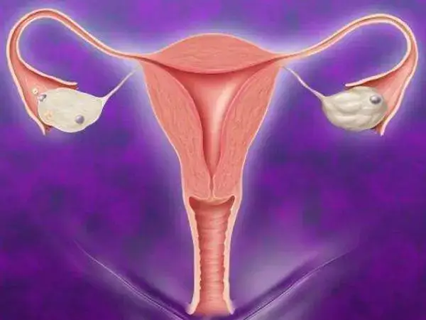取卵对卵巢的伤害有哪些(图1)